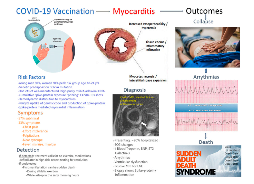 Autopsy Proven Fatal COVID-19 Vaccine-Induced Myocarditis 7